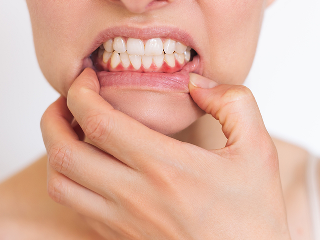 Gum disease risk factors