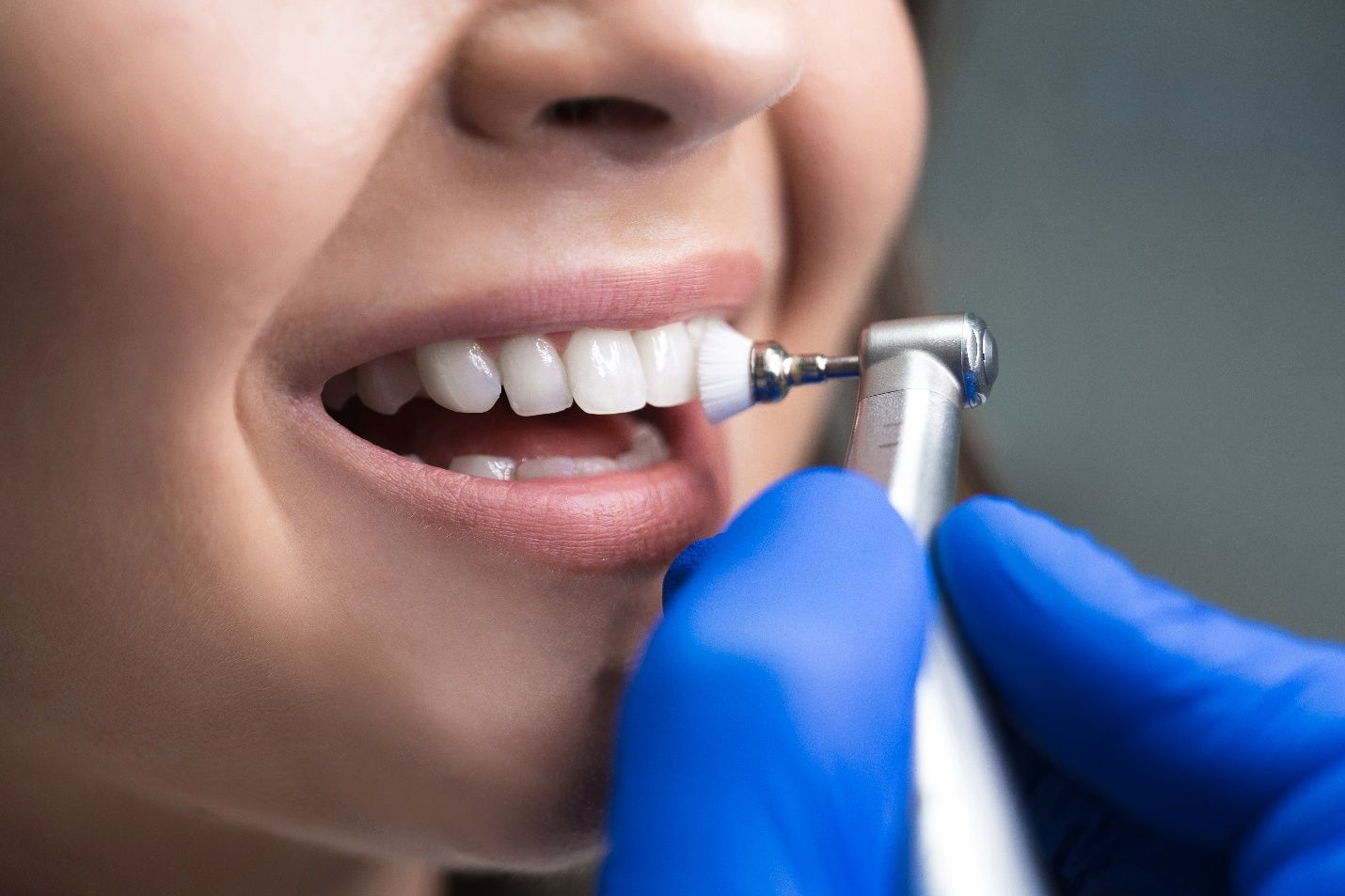 A woman getting a dental checkup near Milton