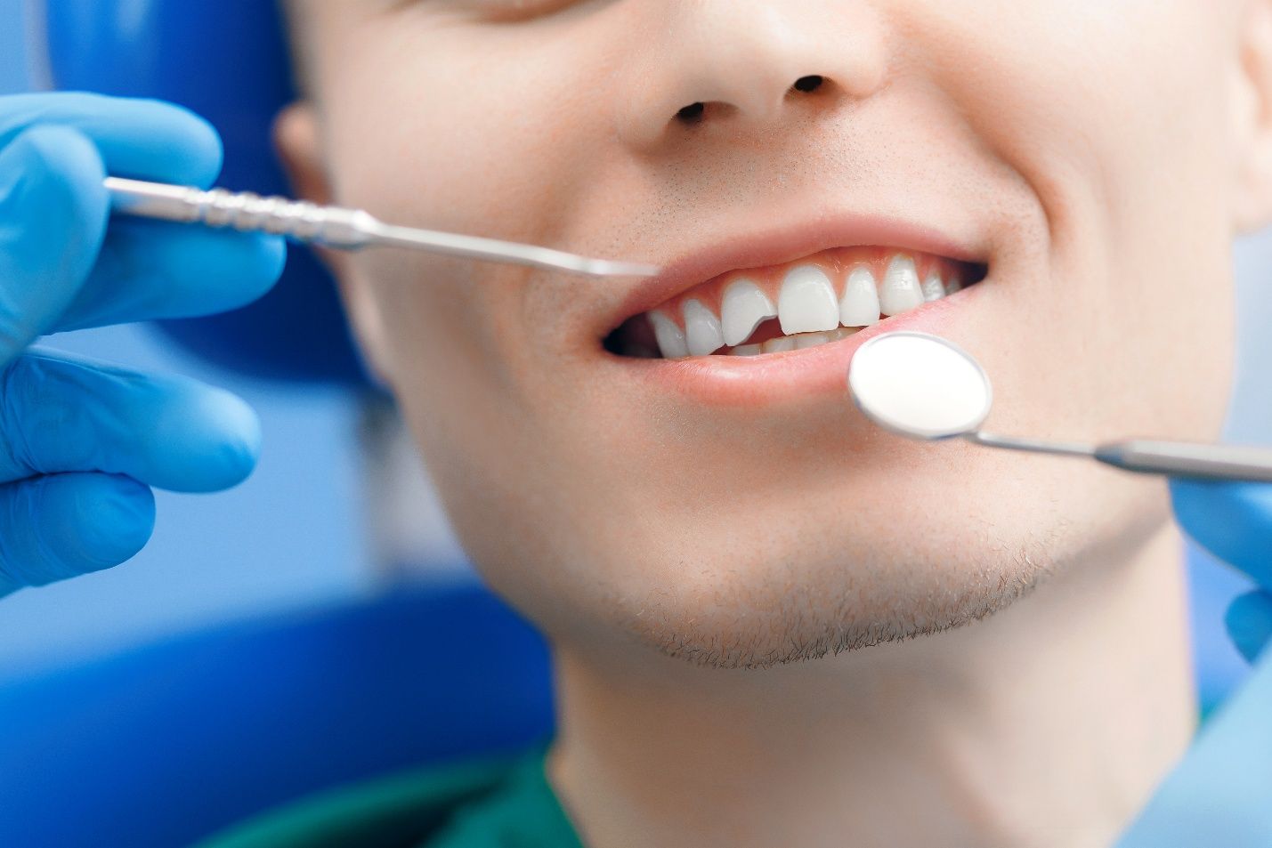 A man with a broken tooth near Milton