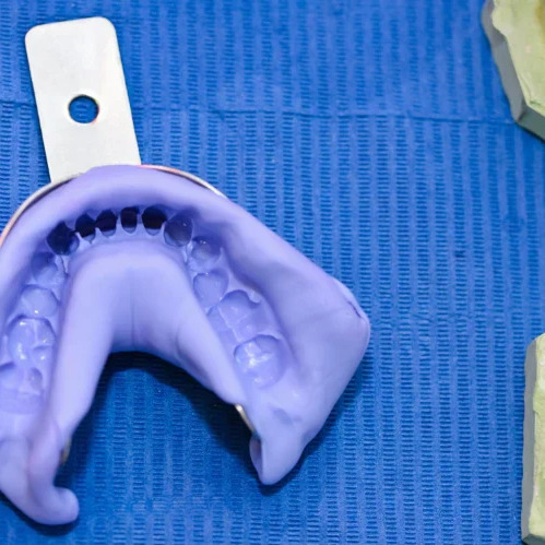 Chipped and worn teeth